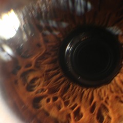 UnimportantlyUnderexadurated