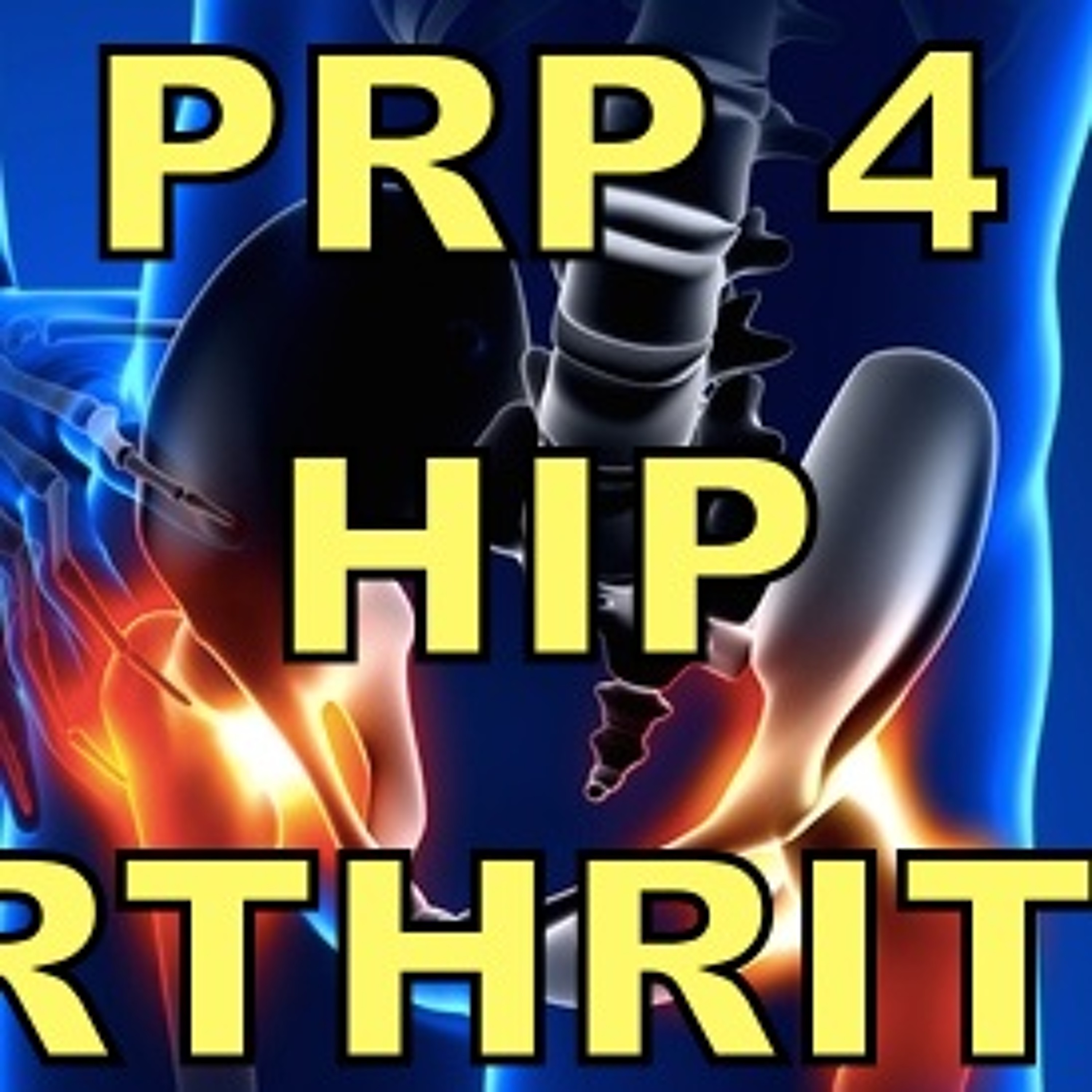 Stem Cell's For Hip Bone On Bone Arthritis episode artwork