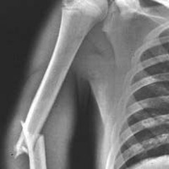 BONE FUCK (prod. kurt ness)