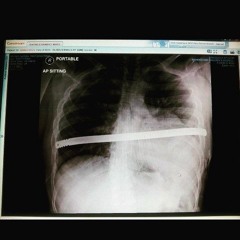 i need a doctor/bring me back to life