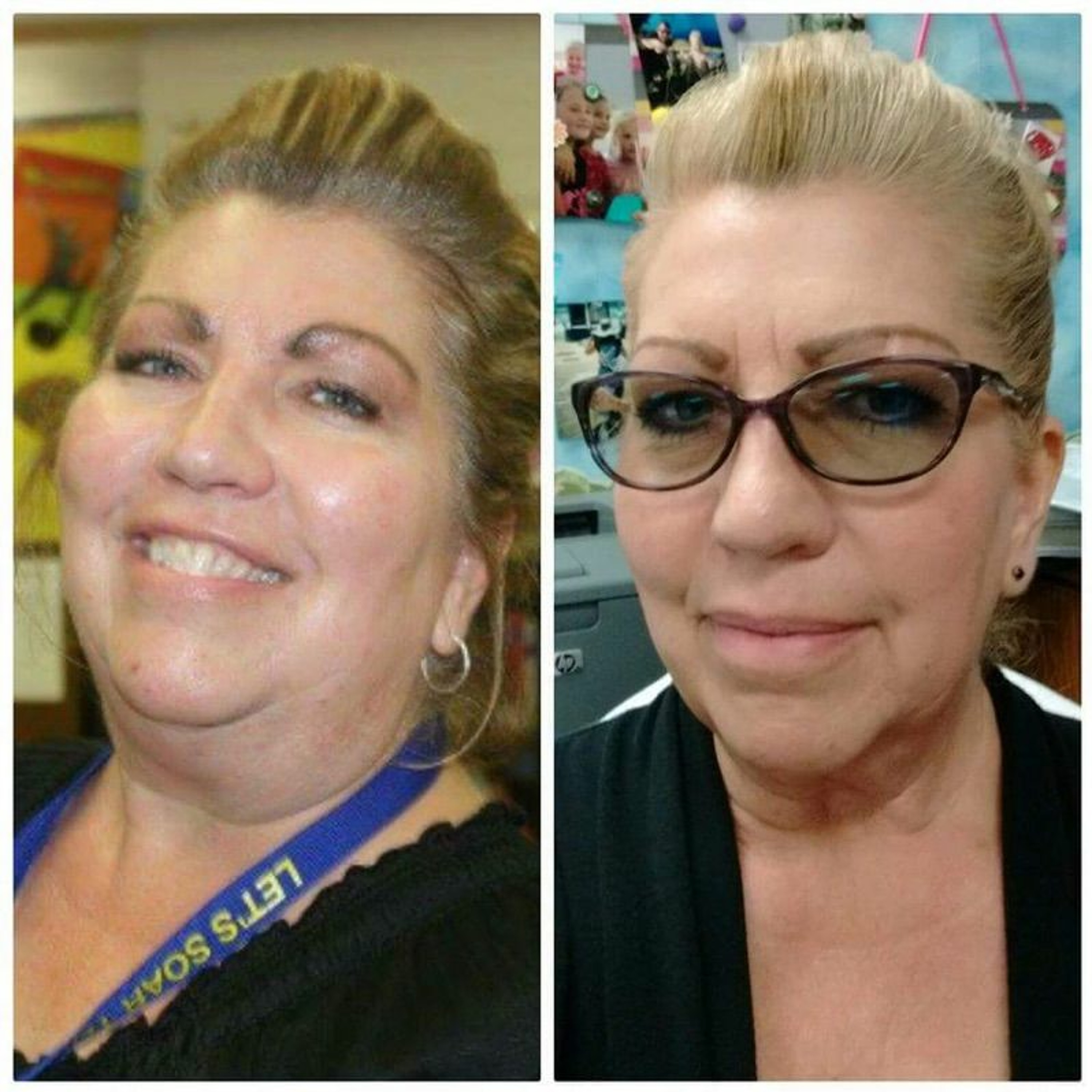 WP Thyroid Weight Loss: 55 pounds over 6 months with Before/After pictures