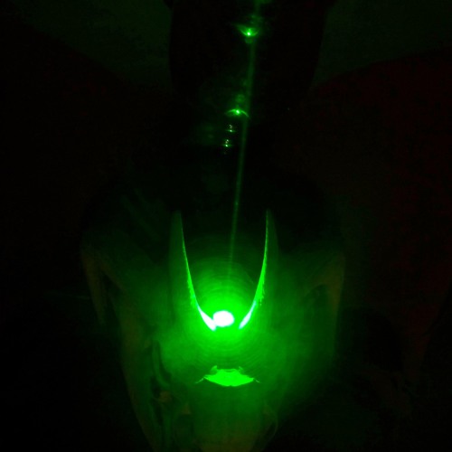 Earth and Man Crying Each Other to Sleep (Tears of Fukushima).