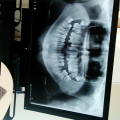 747- Parasitica (Original)