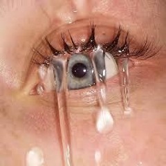 DamnWhyMyEyeWatering