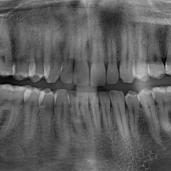 Ikki - A 3 TUBA (Original Mix)