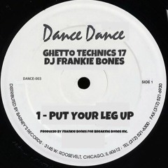 PUT YOUR LEG UP
