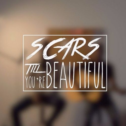 Stream Scars To Your Beautiful Alessia Cara (SASSIOUI SALMA COVER) by