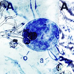 Amoeba - Yokna HASEGAWA （長谷川億名）