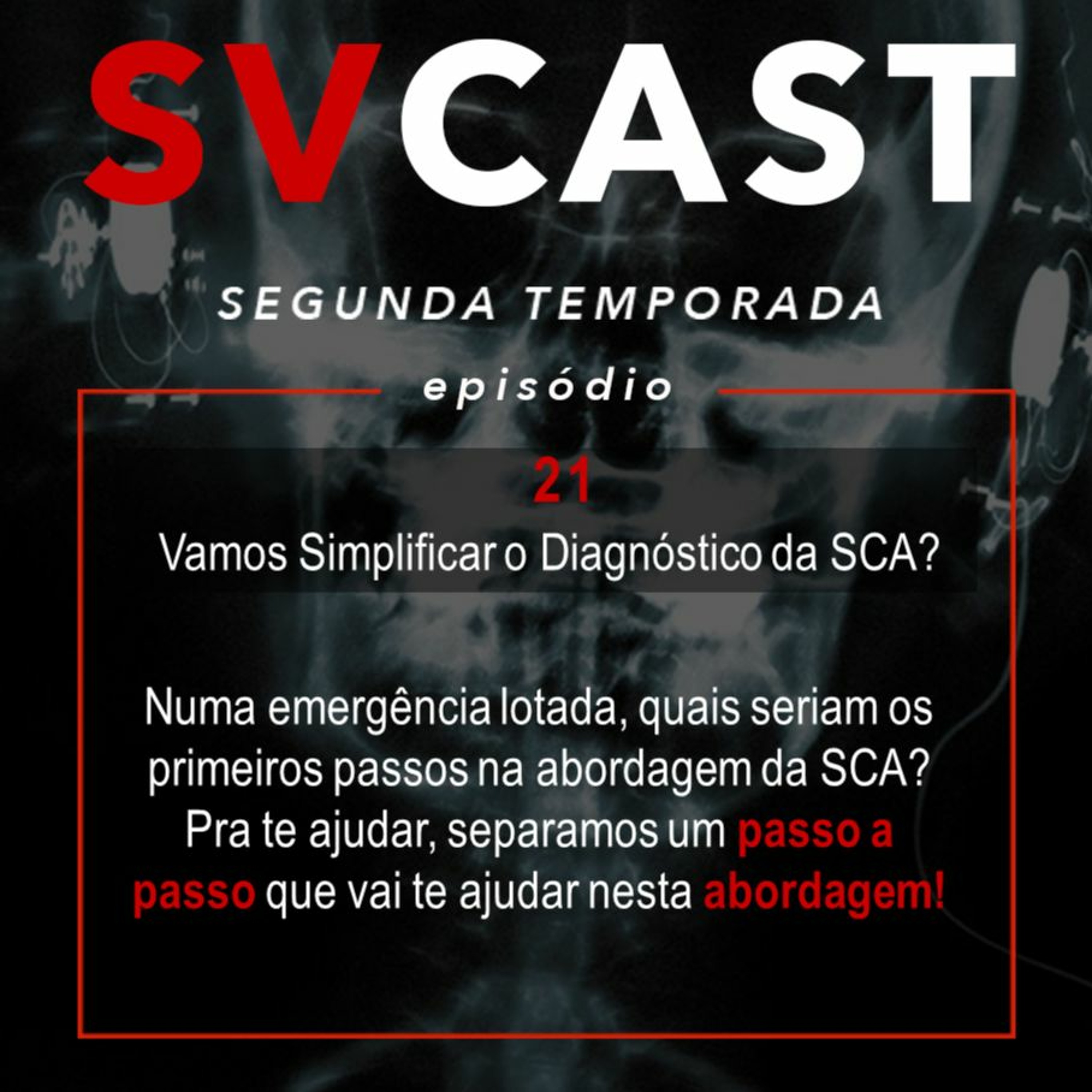 SVCAST #21 - Vamos Simplificar o Diagnóstico da Síndrome Coronariana Aguda?