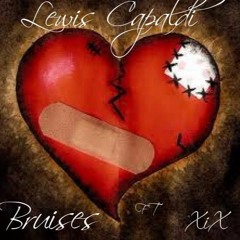 Bruises Ft Lewis Capaldi