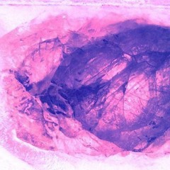 Discogorgia