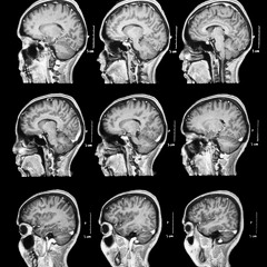 Schpruetzema - G2e, J-Buttaz & Lawncee feat Lil Bruzy