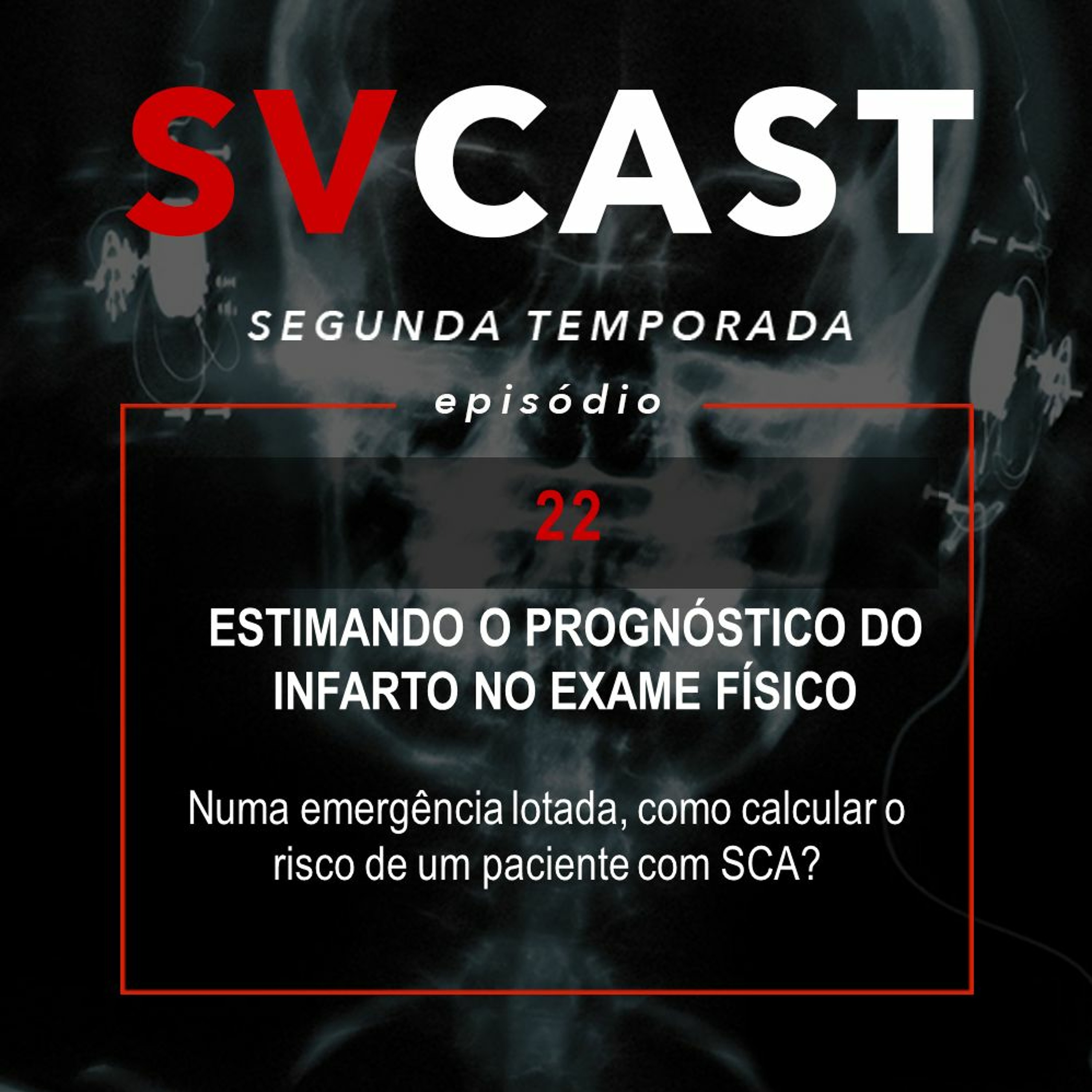 SVCAST #22 - ESTIMANDO O PROGNÓSTICO DO INFARTO NO EXAME FÍSICO