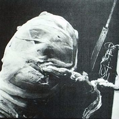 Self-Immolation