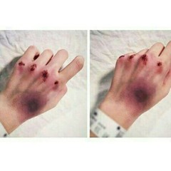 اكتئاب
