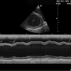 Circulation Sanguine