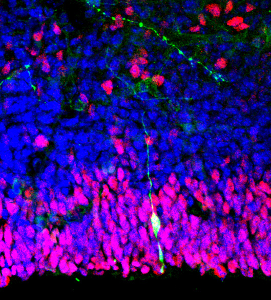 The Power in Your Fat - DrG talks with Dr. Tami Meralia about stem cell therapy episode artwork