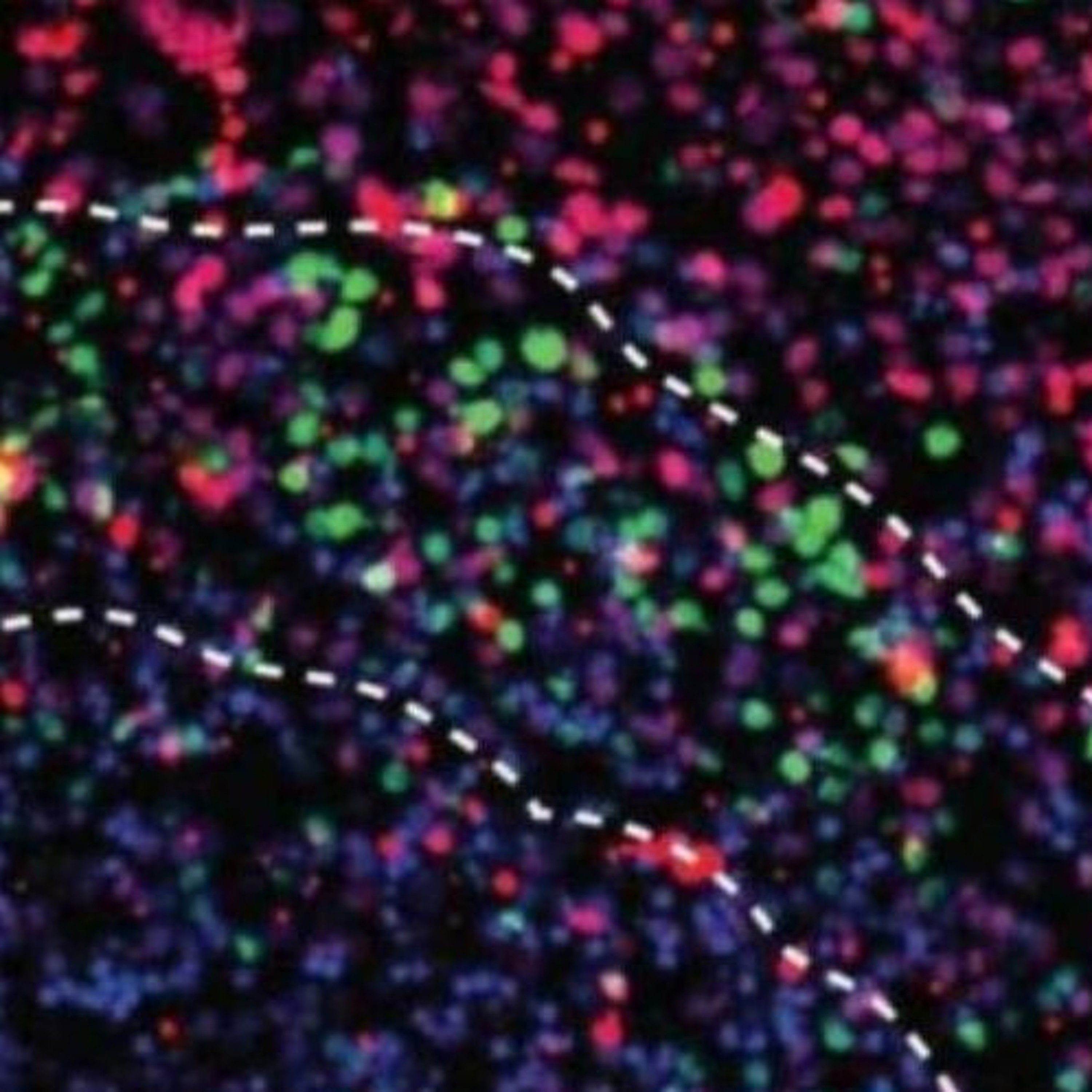 Have you ever heard of a mini brain?