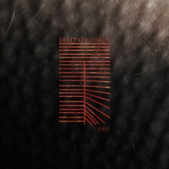 Ringo LIVE - Episode (90sec Snippet) CATALOG # SKIN001