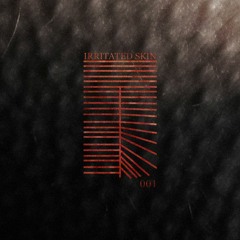 Ringo LIVE - Mine (90sec Snippet) CATALOG # SKIN001