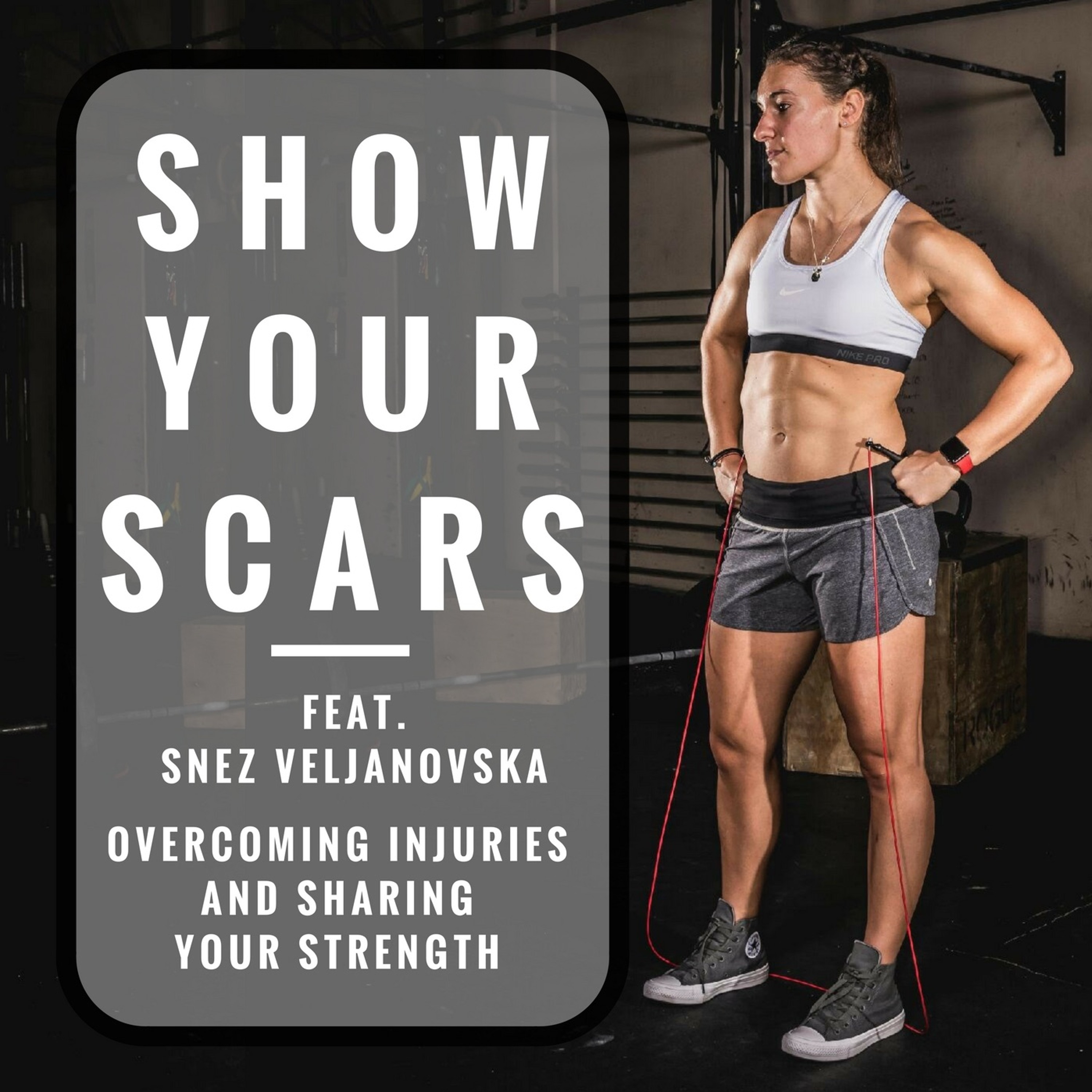 Show Your Scars