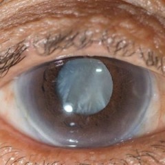 The Tell-Tale Heart by Edgar Allen Poe