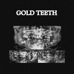 Gold Teeth