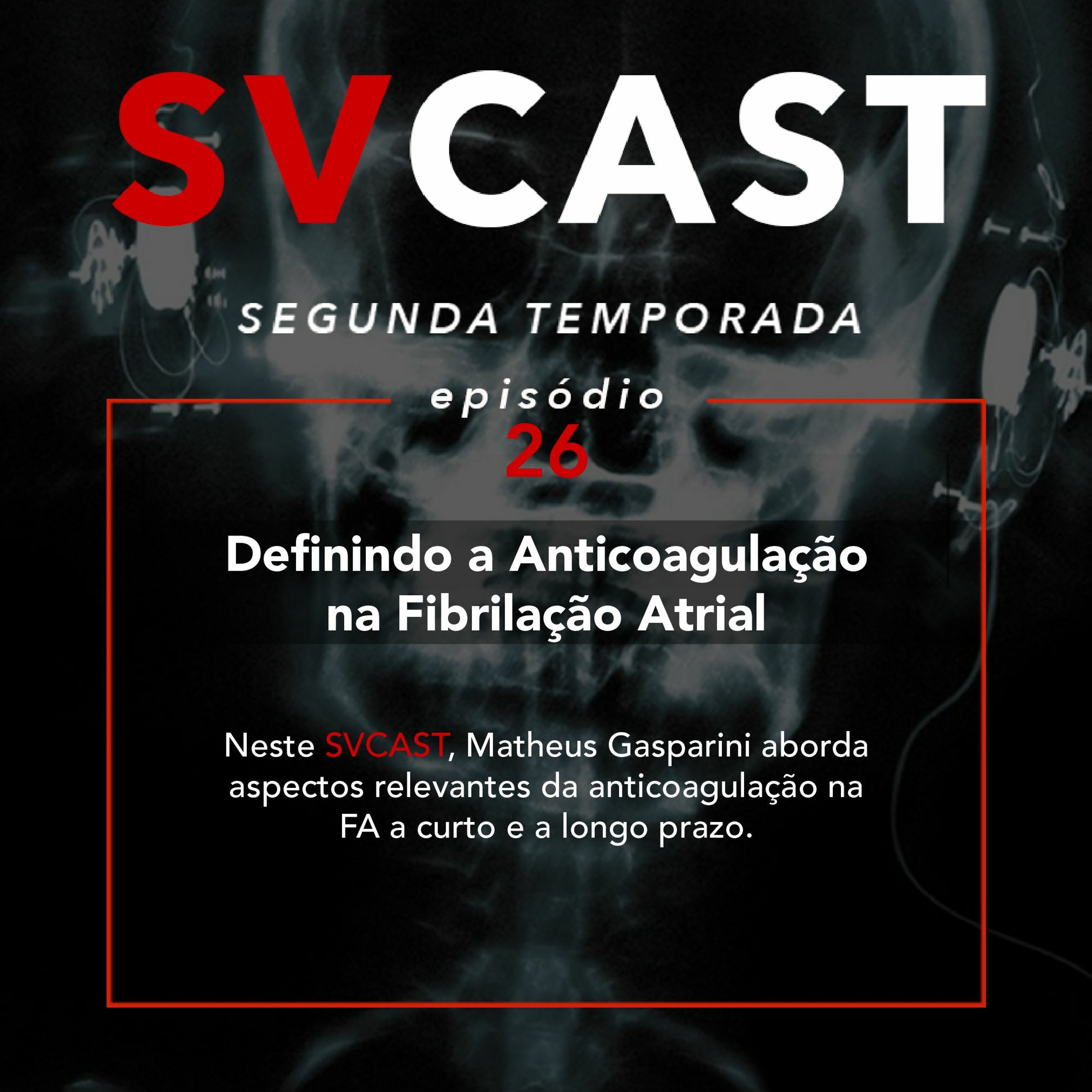 SVCAST #26 - DEFININDO A ANTICOAGULAÇÃO NA FIBRILAÇÃO ATRIAL