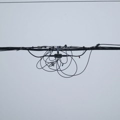 How does eye surgery work | Anna Francis and Matthew