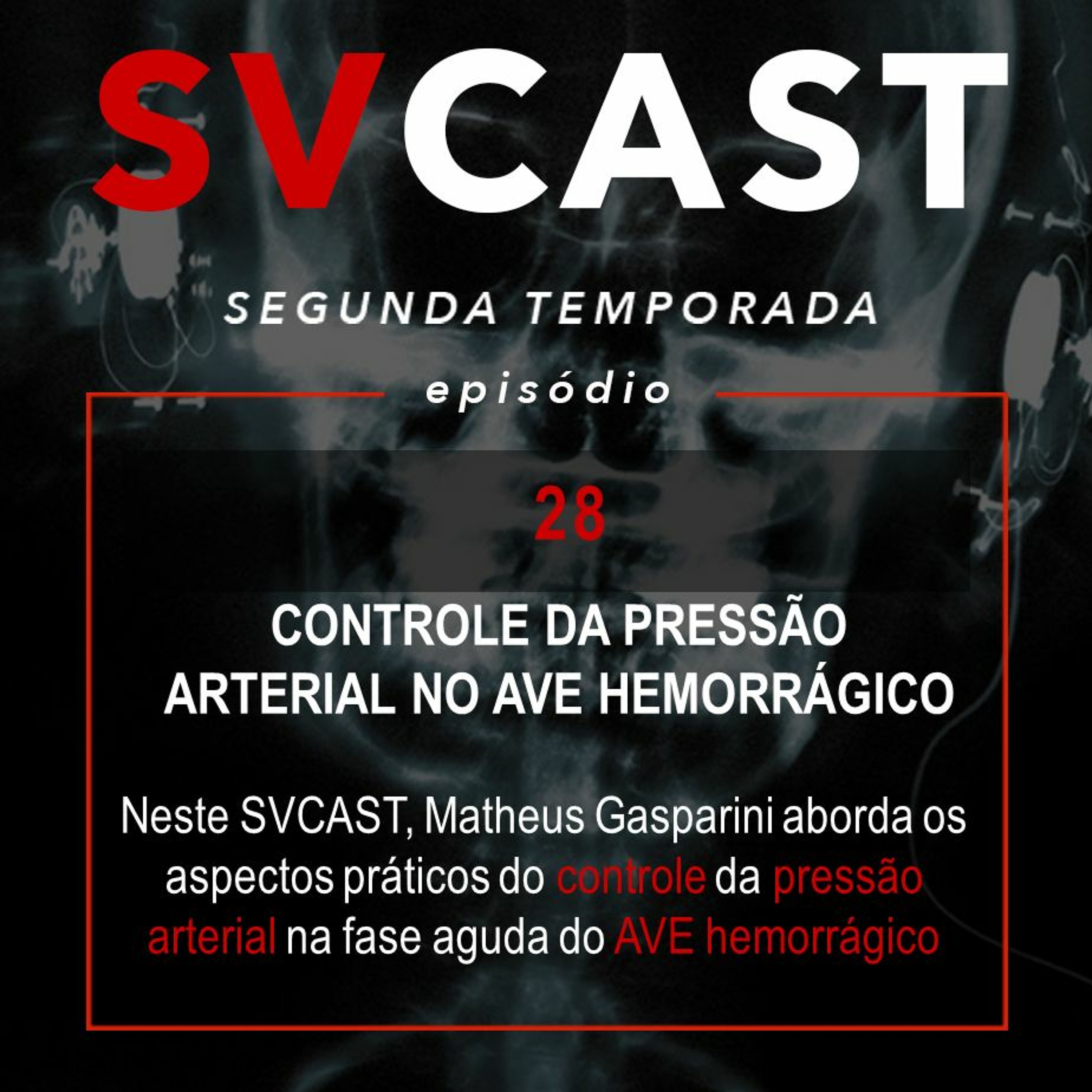 SVCAST #28 - CONTROLE DA PRESSÃO ARTERIAL NO AVE HEMORRÁGICO