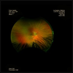 Farewell to a Friend