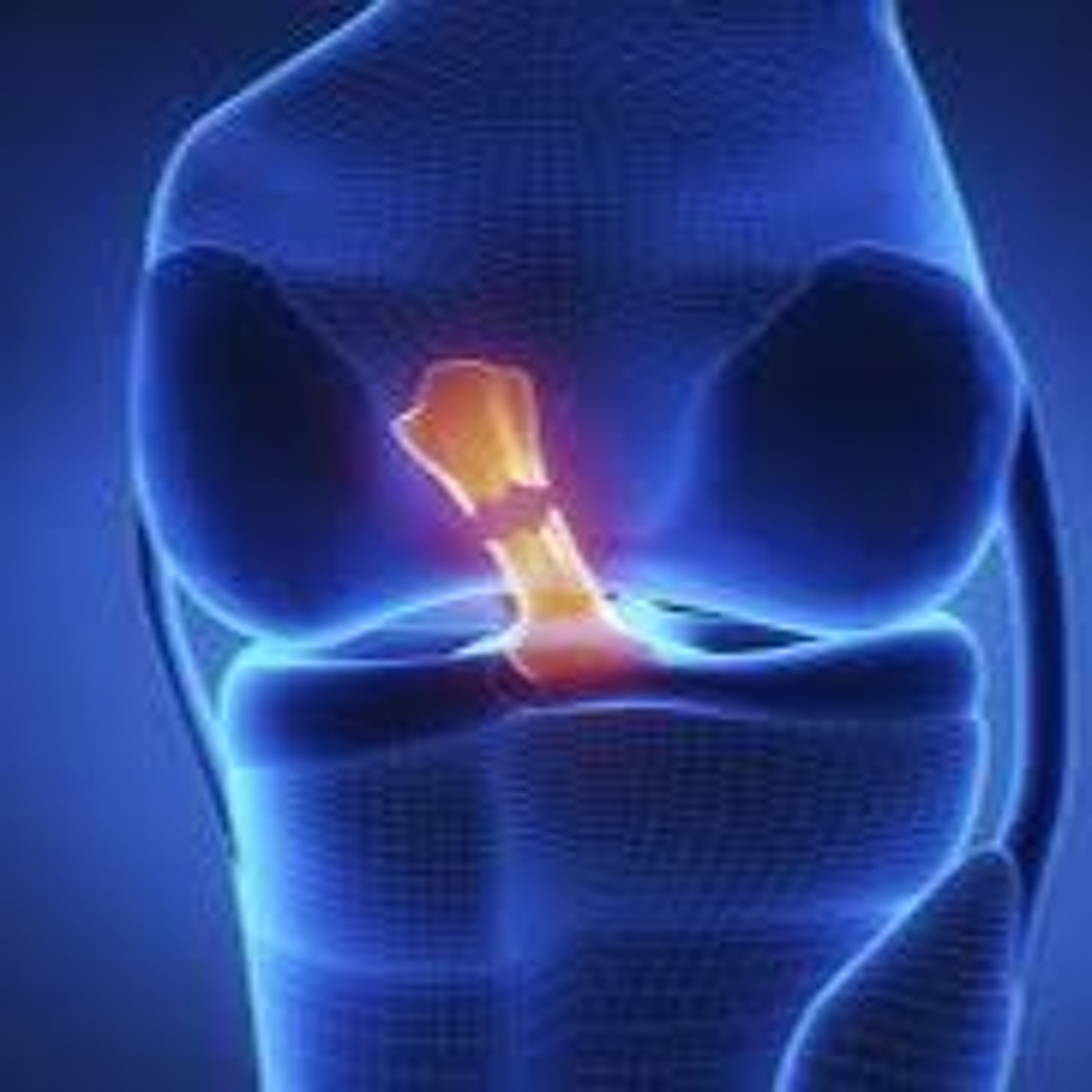 Can a completely ruptured ACL repair itself??