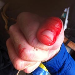 Surfer describes moment a shark bit him on the leg at Bantham