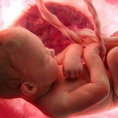 Дослівно - АБОРТ – вибір жінки, гріх чи злочин?