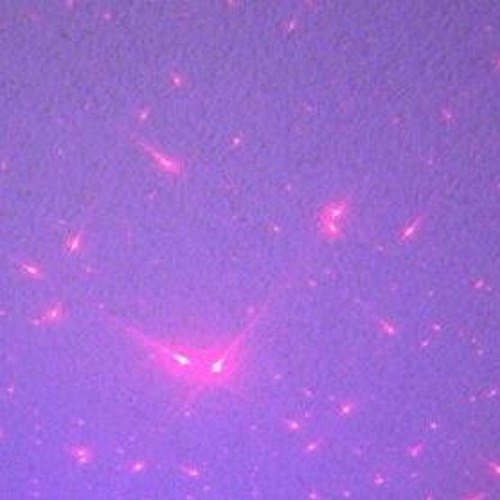 hyperlove / unrest