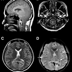 Brain Life Center
