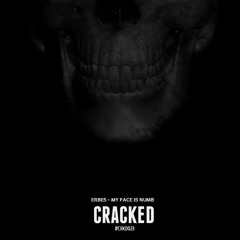 Erbes - My Face Is Numb [Out Now]