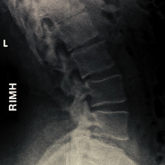 THE BY GODS - Rat In My House