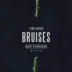 Lewis Capaldi - Bruises (Guy Furious Refix)
