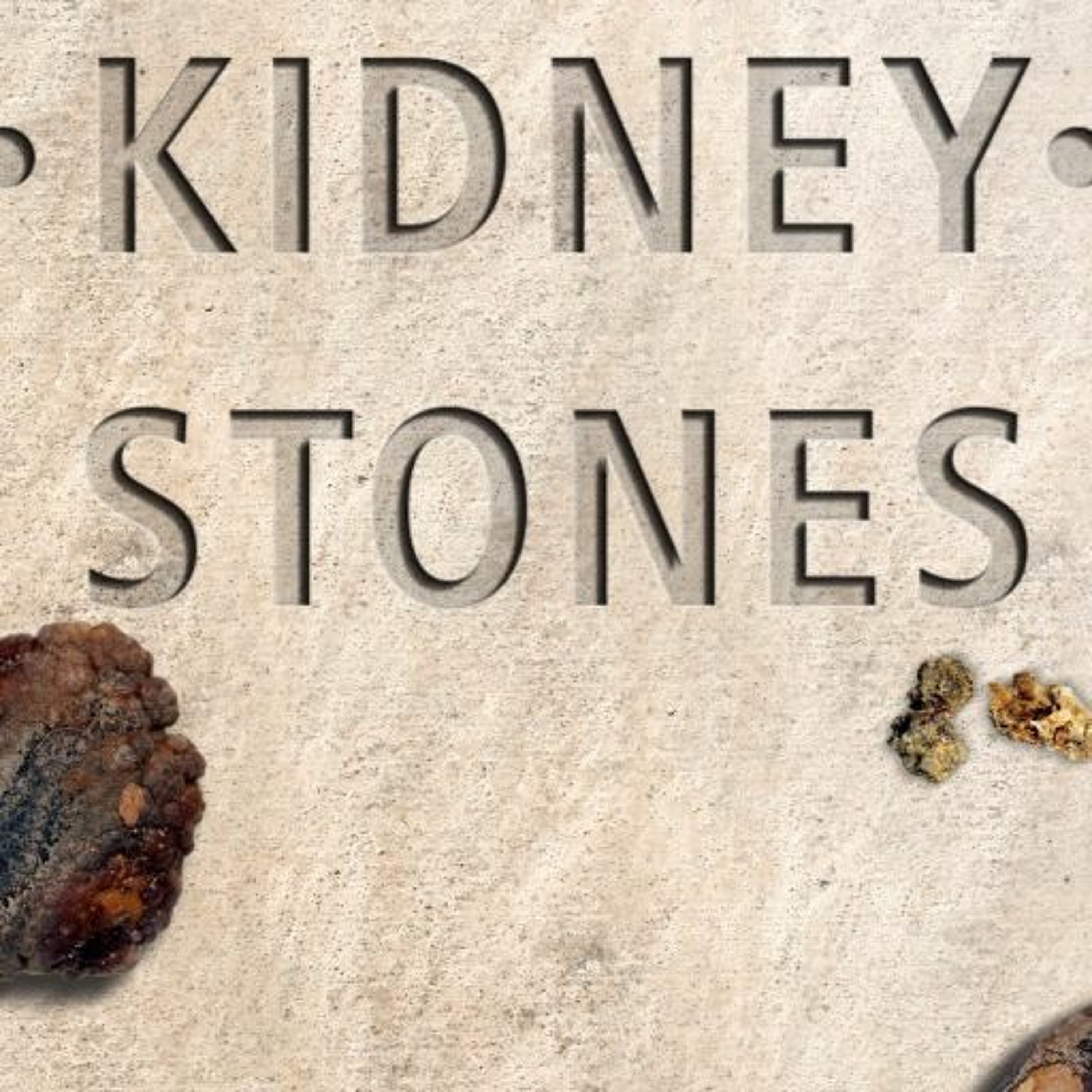 What You Need to Know about Kidney Stones with Dr. Tim Averch episode artwork