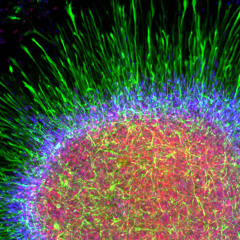 Astrocytes 2 - Destiny