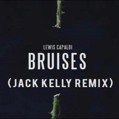 Lewis Capaldi -  Bruises (Jack Kelly Remix)