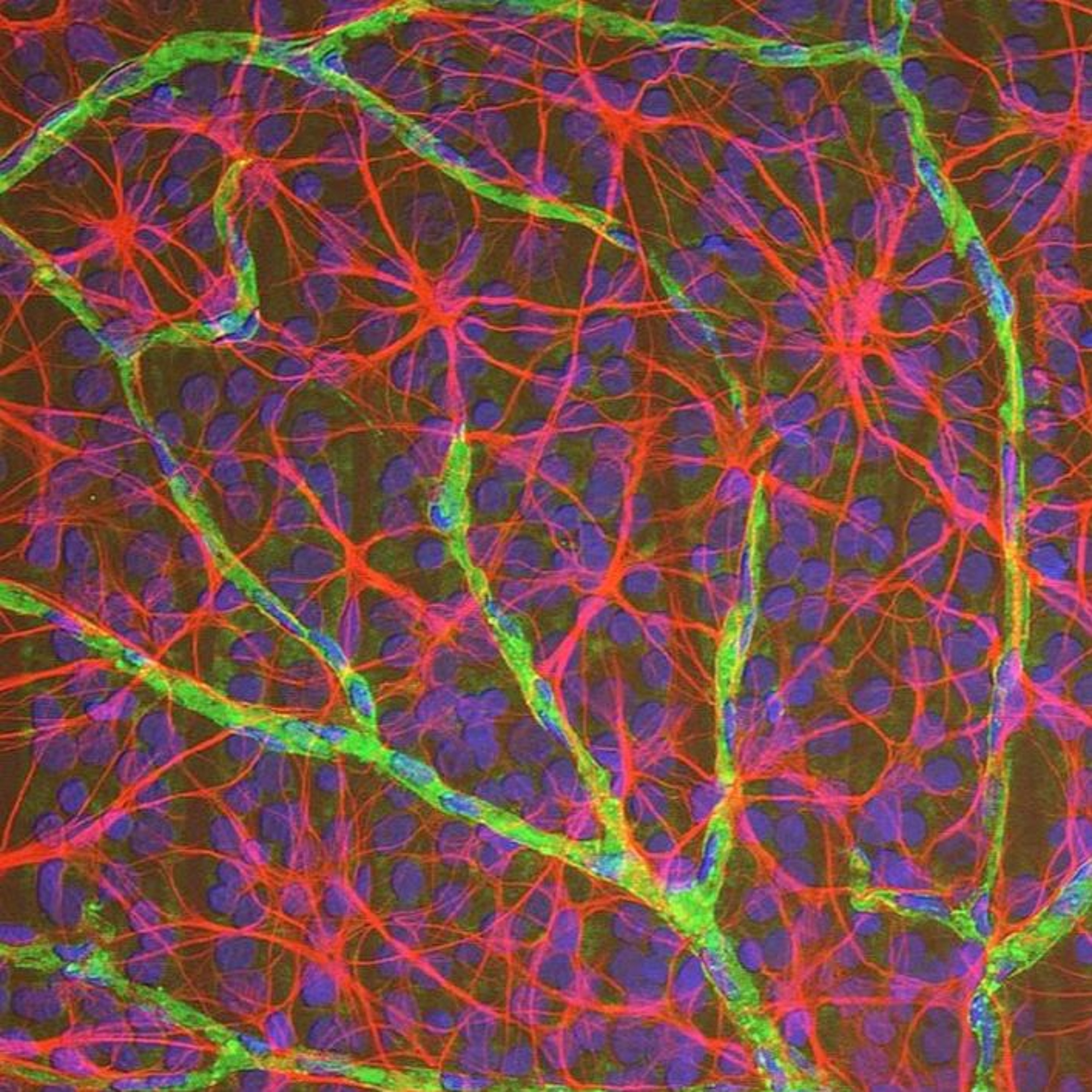 Astrocytes