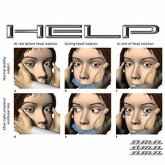 HEL_P