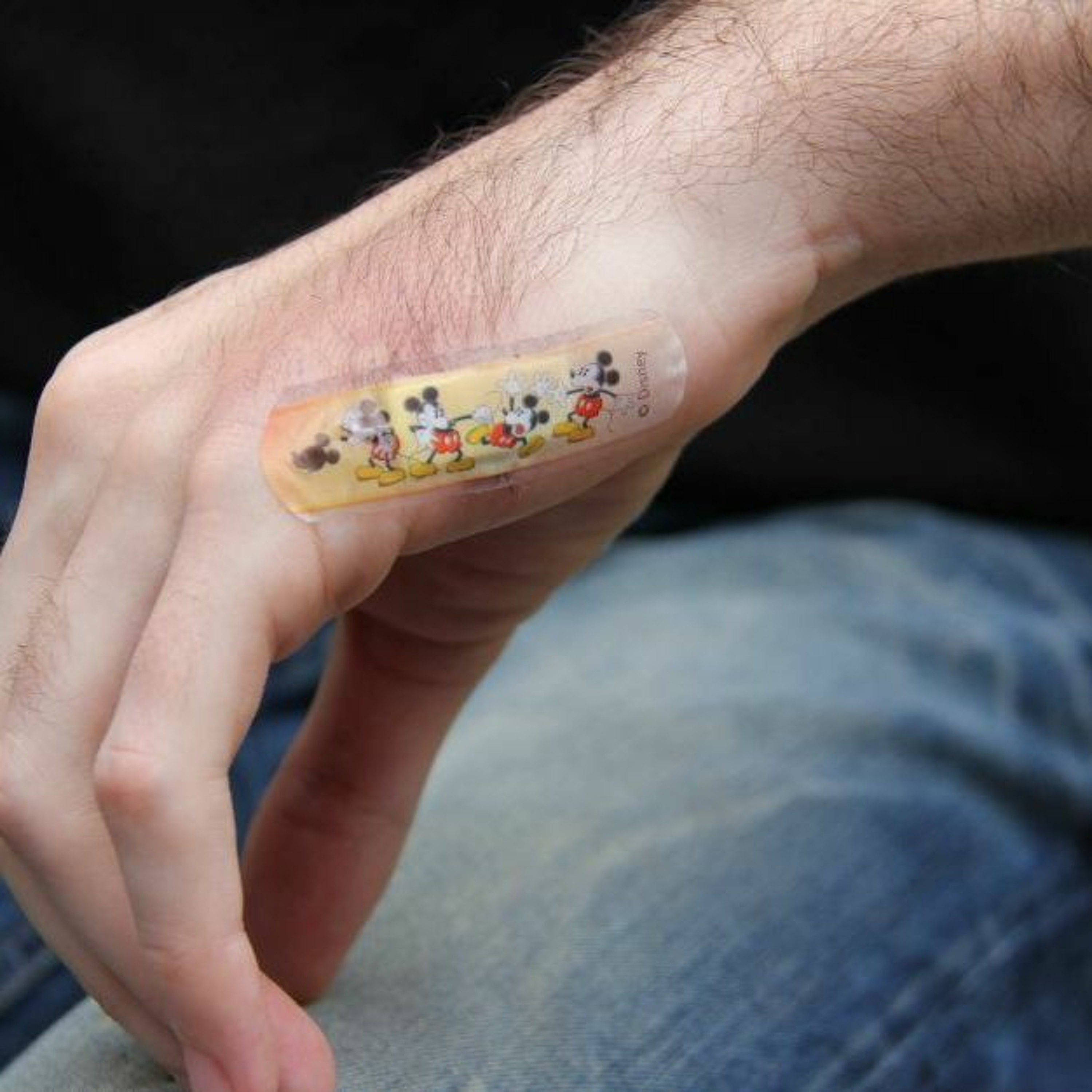 Man implants transit card in his hand to make life easier thumbnail