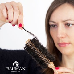 Female Hair Loss Treatments