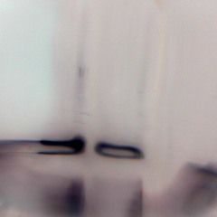 Eartheater Virus (c.billon)