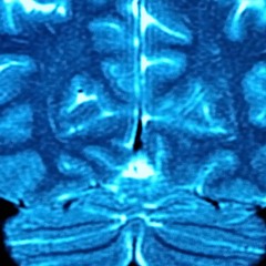 mehum - Diffuse Psyche Radiation