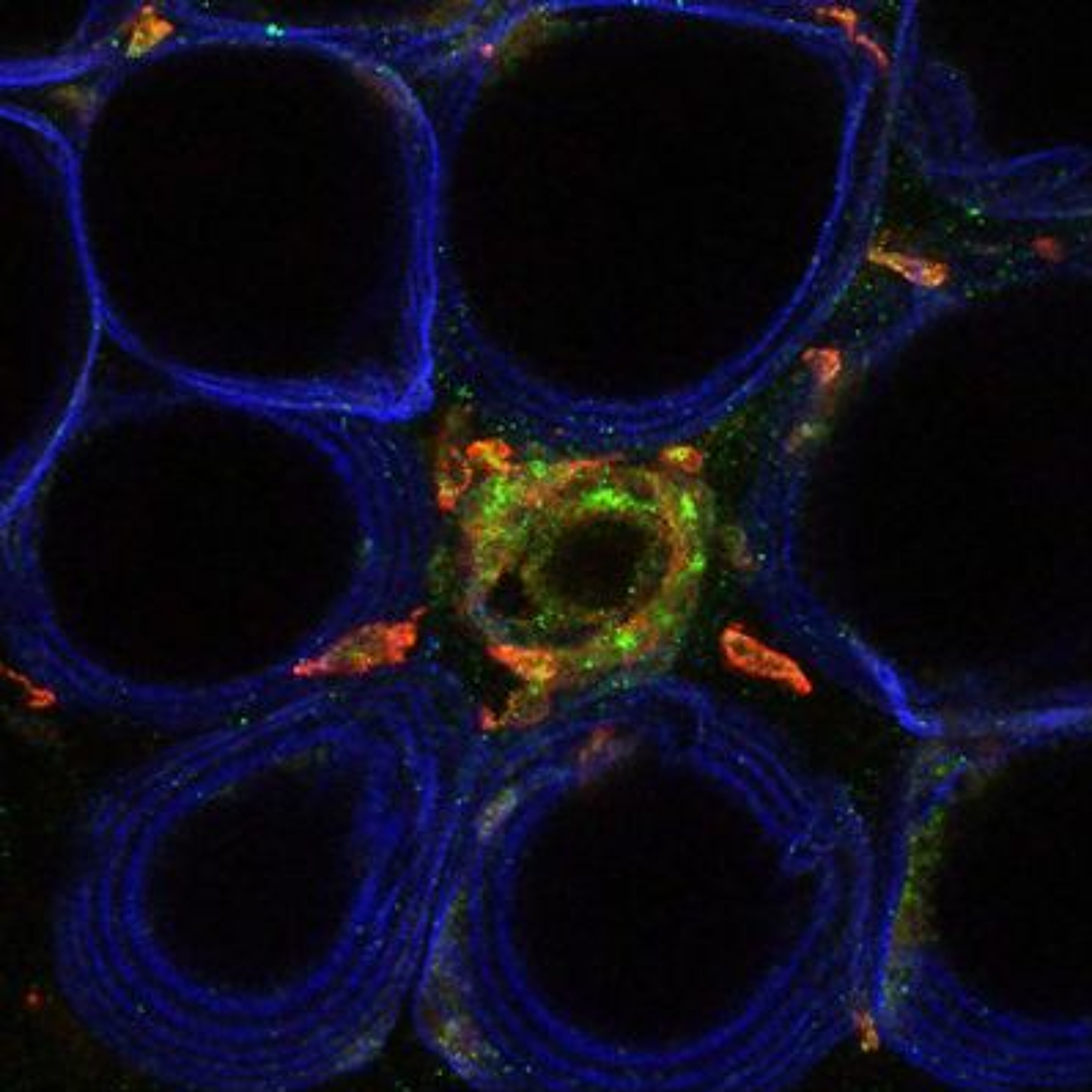 n=19 How an old asthma drug could be a new diabetes treatment