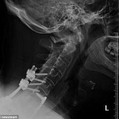 Ugly - Neck Snapper (mix)